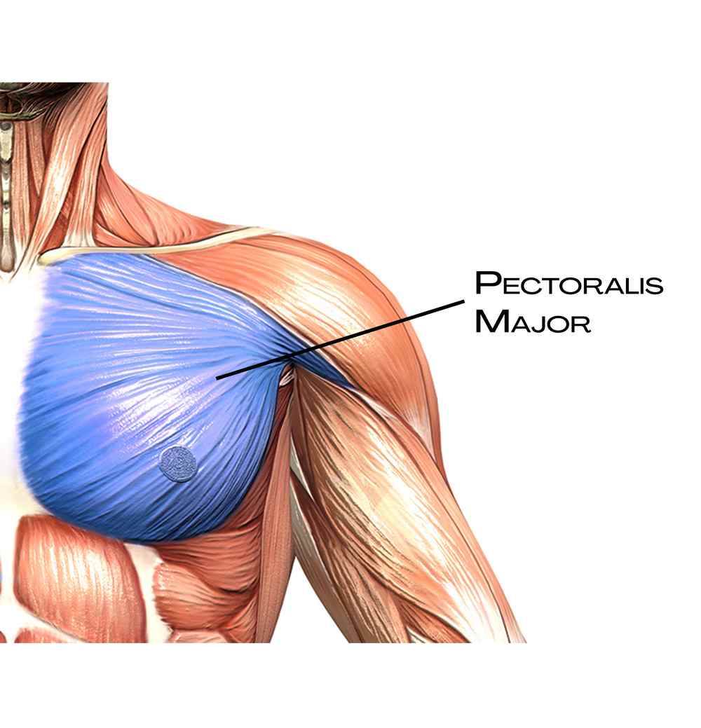 Pectoralis major v povrchové přední linii hrudníku
