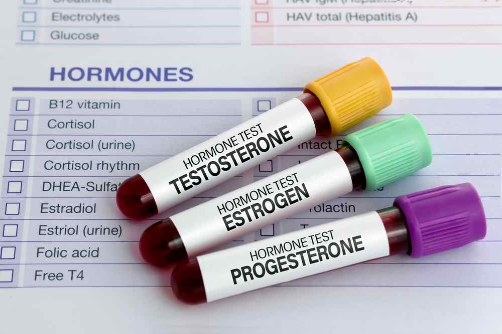 Zkumavky s krví označené testosteron, estrogen a progesteron na laboratorním formuláři